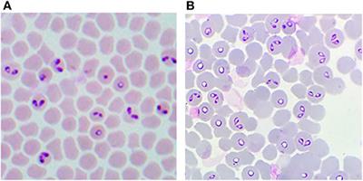 An Overview of Current Knowledge on in vitro Babesia Cultivation for Production of Live Attenuated Vaccines for Bovine Babesiosis in Mexico